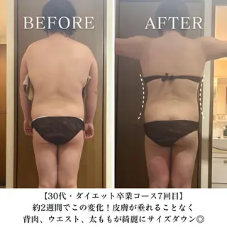 【目黒】本格痩身✴︎ 最新型よもぎ蒸しのエステ・リラクイメージ