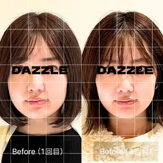 小顔・たるみ専門 DAZZLEのエステ・リラクイメージ