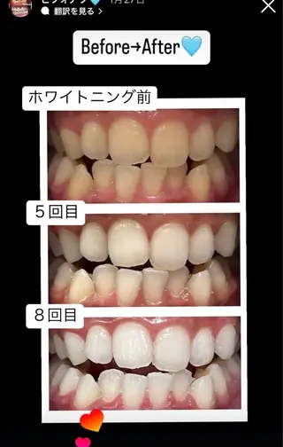 Kaula ホワイトニング🦷✨のエステ・リラクイメージ