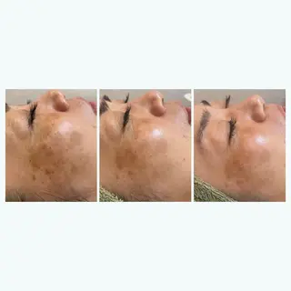 ROOM.S ｜脱毛｜美肌｜ボディのエステ・リラクイメージ