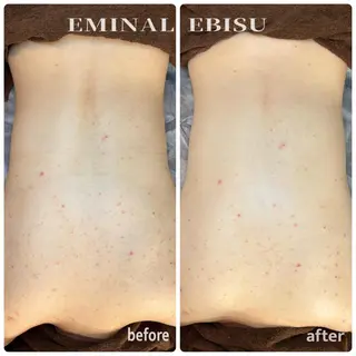 EMINAL恵比寿 HITOMIのエステ・リラクイメージ