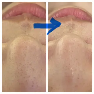 Blue Moon 【ブルームーン】のエステ・リラクイメージ