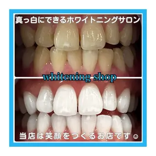 ホワイトニング ショップ浦和店のその他イメージ