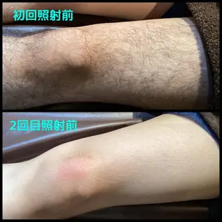 メンズ メンズ脱毛ECXIA所属・men's脱毛サロン ECXIAのエステ・リラクイメージ