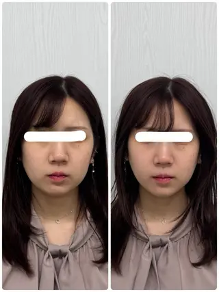 美容鍼×小顔矯正 ×美容整体　浜川泰仁のエステ・リラクイメージ