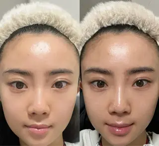 マツエク・マツパ aliaハイフ&水光ジェットサロン所属・aliaハーブ水光店 エステティシャン募集のエステ・リラクイメージ