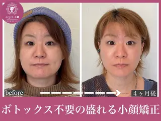 盛れる小顔矯正師 たく先生のエステ・リラクイメージ