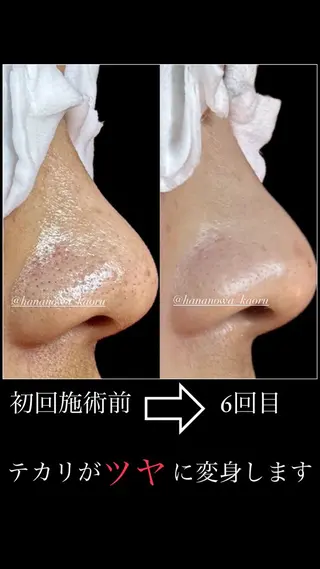 毛穴&リンパマッサー ジ専門サロン花のWAのエステ・リラクイメージ