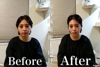 鍼灸 Refineのその他イメージ