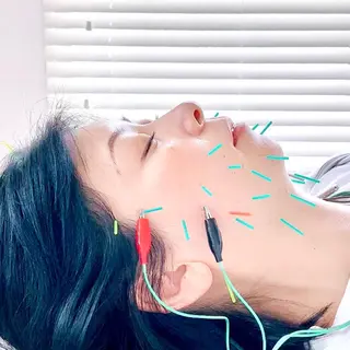 印象の良くなる 美容鍼のエステ・リラクイメージ