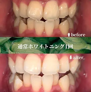 futaba ホワイトニング/天神のエステ・リラクイメージ