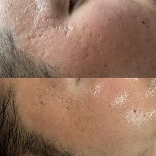 エステサロン Venusのその他イメージ