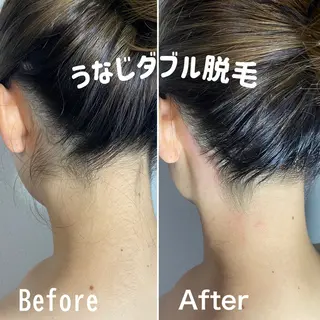 エピナス町田店 ブラジリアンワックスのエステ・リラクイメージ