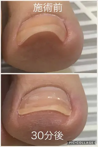 ネイル salon Noelのネイルデザイン