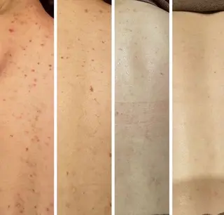 ハーブ&艶肌ワックス re:proのエステ・リラクイメージ