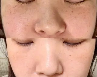 M渋谷店所属・M渋谷 ホワイトニングのエステ・リラクイメージ