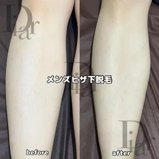 メンズ Diar salon もものエステ・リラクイメージ