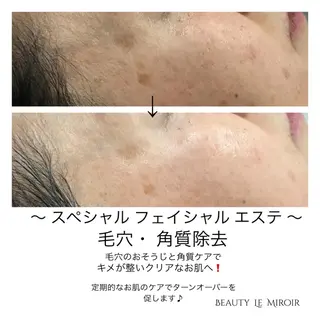 ビューティー ミロワールのエステ・リラクイメージ