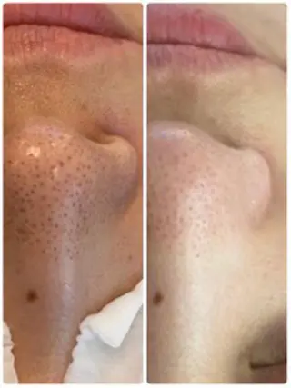 CHERIE Hisadaのエステ・リラクイメージ