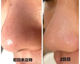 小林 玲菜のエステ・リラクイメージ