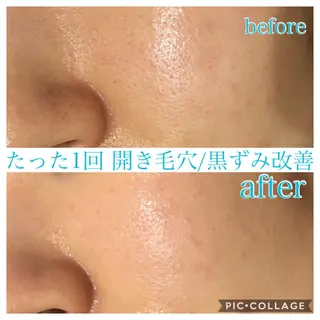 ミディアム カラー パーマ ヘアアレンジ キッズ ネイル マツエク・マツパ EnsorClair 代表 野口真央のエステ・リラクイメージ