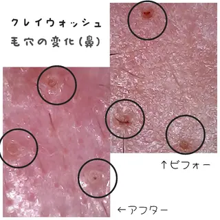 畑 彩愛のエステ・リラクイメージ