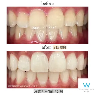 ホワイトニングショップ桜木町店所属・ホワイトニング ショップ桜木町店のその他イメージ