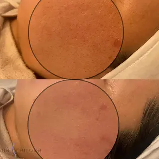 amu nail. RINAのネイルデザイン