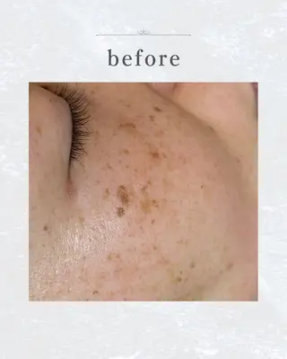 シミ・毛穴ケア専門 クロヌYUKIのエステ・リラクイメージ