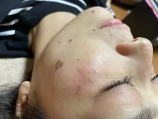 美容鍼・脱毛サロン CURAIMのエステ・リラクイメージ