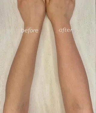 ナチュピ所属・シュガーリングサロン ナチュピのエステ・リラクイメージ