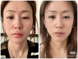 ネイル aliaハーブ水光店 エステティシャン募集のエステ・リラクイメージ