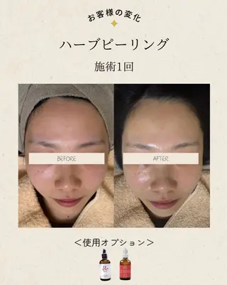 Monart -deux-のエステ・リラクイメージ