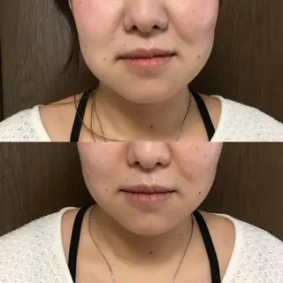 MAREA 小顔SALONのエステ・リラクイメージ