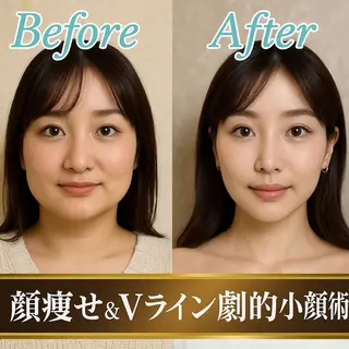 【歴13年】劇的小顔 D rマジックタッチのエステ・リラクイメージ