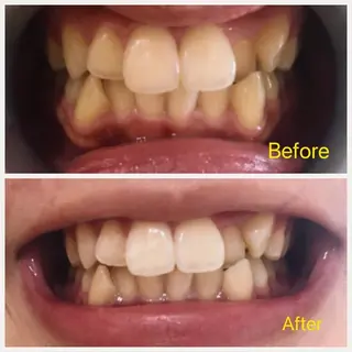 M渋谷 ホワイトニングのエステ・リラクイメージ