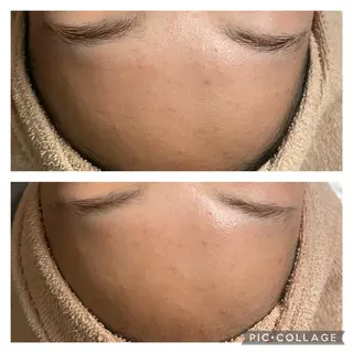 💫Linola💫 レイビス　小林のエステ・リラクイメージ