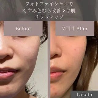 脱毛サロン Lokahiのエステ・リラクイメージ