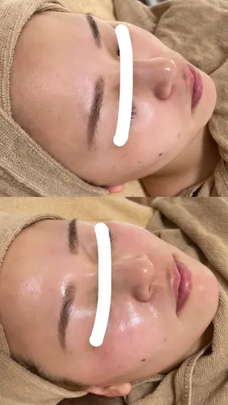 エステサロン Mi-mi.iのエステ・リラクイメージ