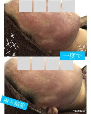 セミロング カラー パーマ ヘアアレンジ メンズ キッズ ネイル マツエク・マツパ 金の糸脱毛 産毛ケア専門のエステ・リラクイメージ