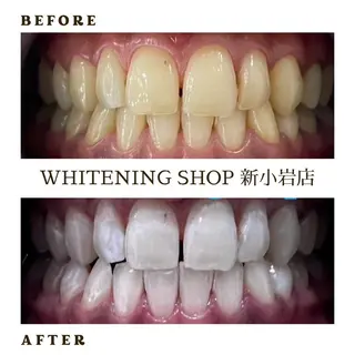 メンズ ホワイトニング ショップ新小岩店のその他イメージ