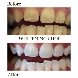 メンズ ホワイトニング専門店 10年の実績|樟葉駅のエステ・リラクイメージ
