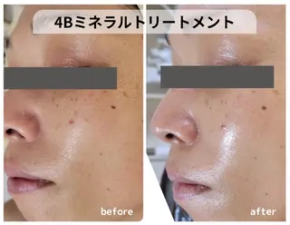 mindplus(マインドプラス)所属・mind plus 【小顔　痩身　脱毛】のエステ・リラクイメージ