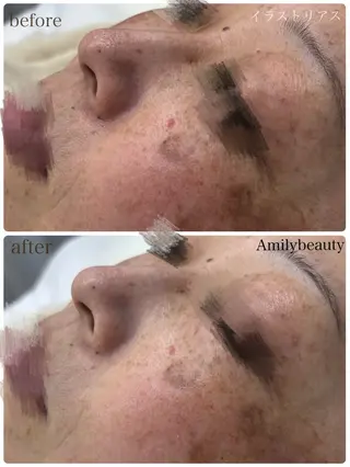 Amily beauty 毛利のエステ・リラクイメージ