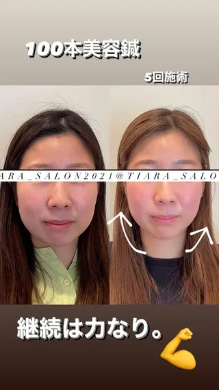 ロング カラー パーマ ヘアアレンジ メンズ キッズ ネイル マツエク・マツパ アイブロウ 鍼灸サロン TIARA　美容鍼のエステ・リラクイメージ