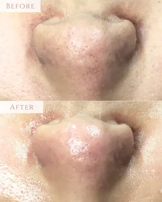 肌質改善専門サロン Bellmi/心斎橋のエステ・リラクイメージ