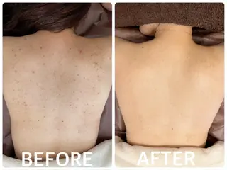 ハーブピーリング横浜 肌質改善専門店のその他イメージ