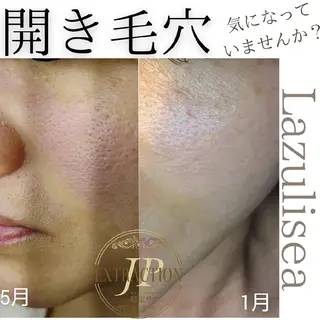 エステサロン Lazulisea所属・川口 春奈のエステ・リラクイメージ