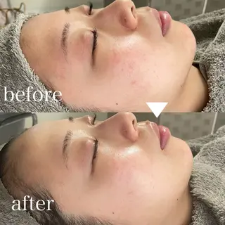 LBSホワイトニング 🌐岡山店のその他イメージ