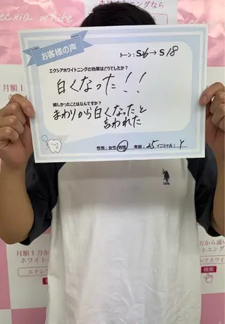 セルフホワイトニング エクシアエミフル店のその他イメージ